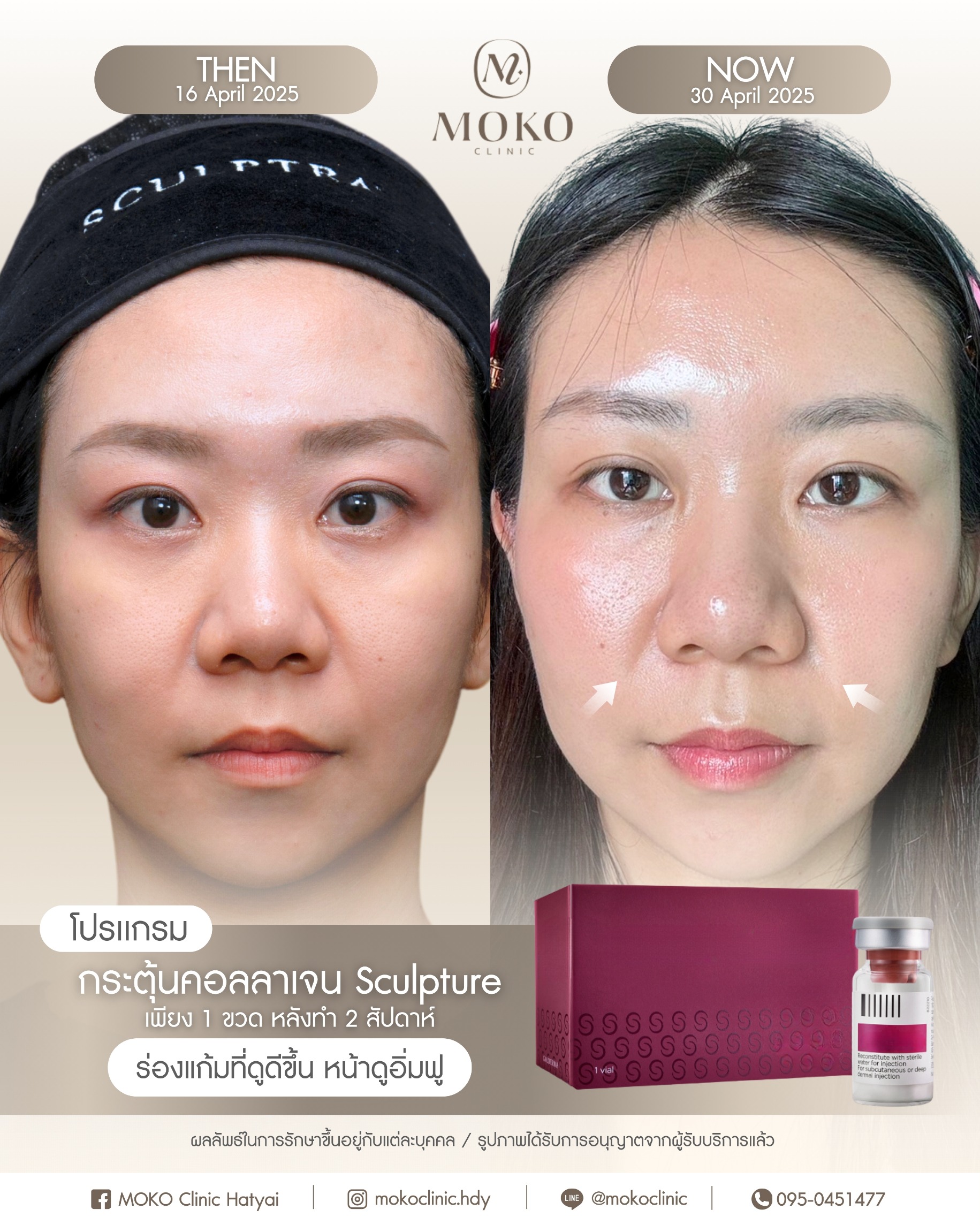 Before After Results 1